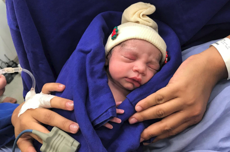 1st baby born using uterus transplant